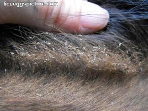 pictures-of-body-lice-bites